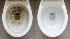 Your toilet will look like new thanks to this affordable remedy — expert tips